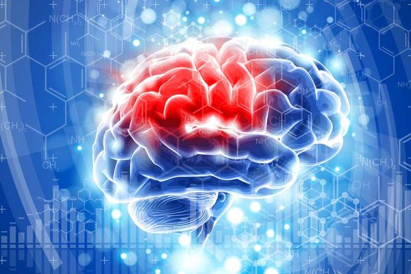 Neurologie